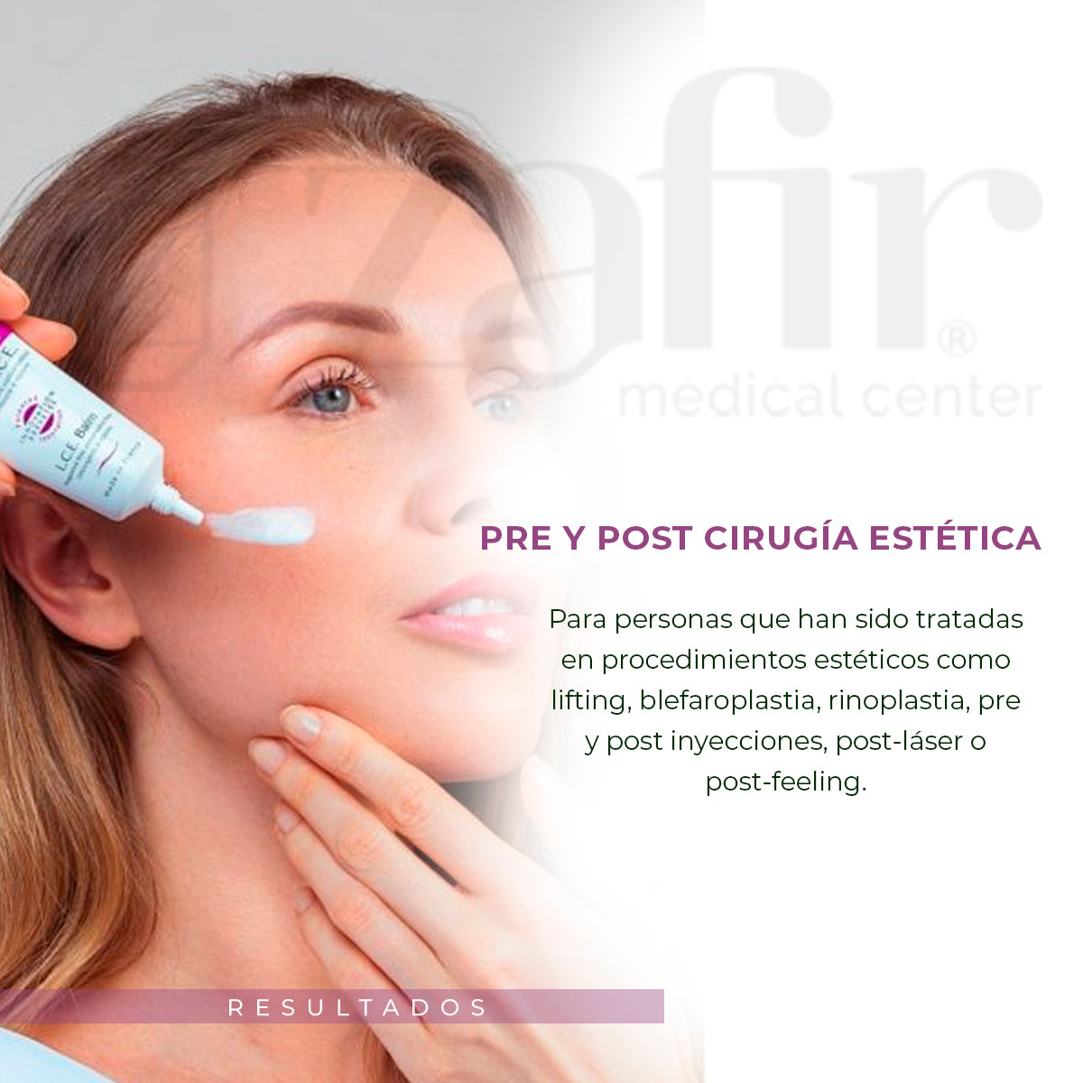 CEBELIA Baume L.C.E - Bálsamo Anti-Moretones, Anti-edema (15 ml)