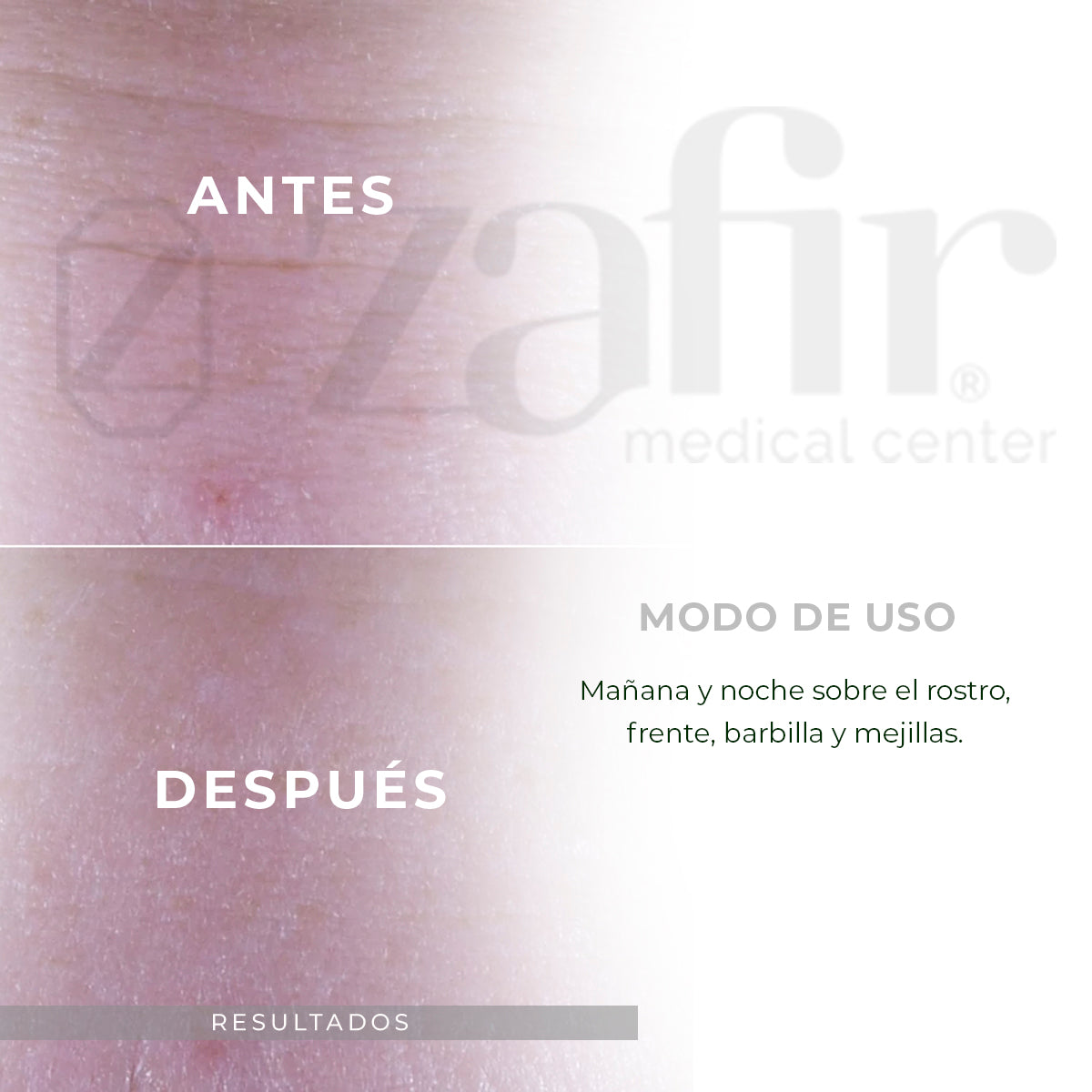 Suero Efecto Lifting PATYKA - AGE SPECIFIC INTENSIF Reafirmante