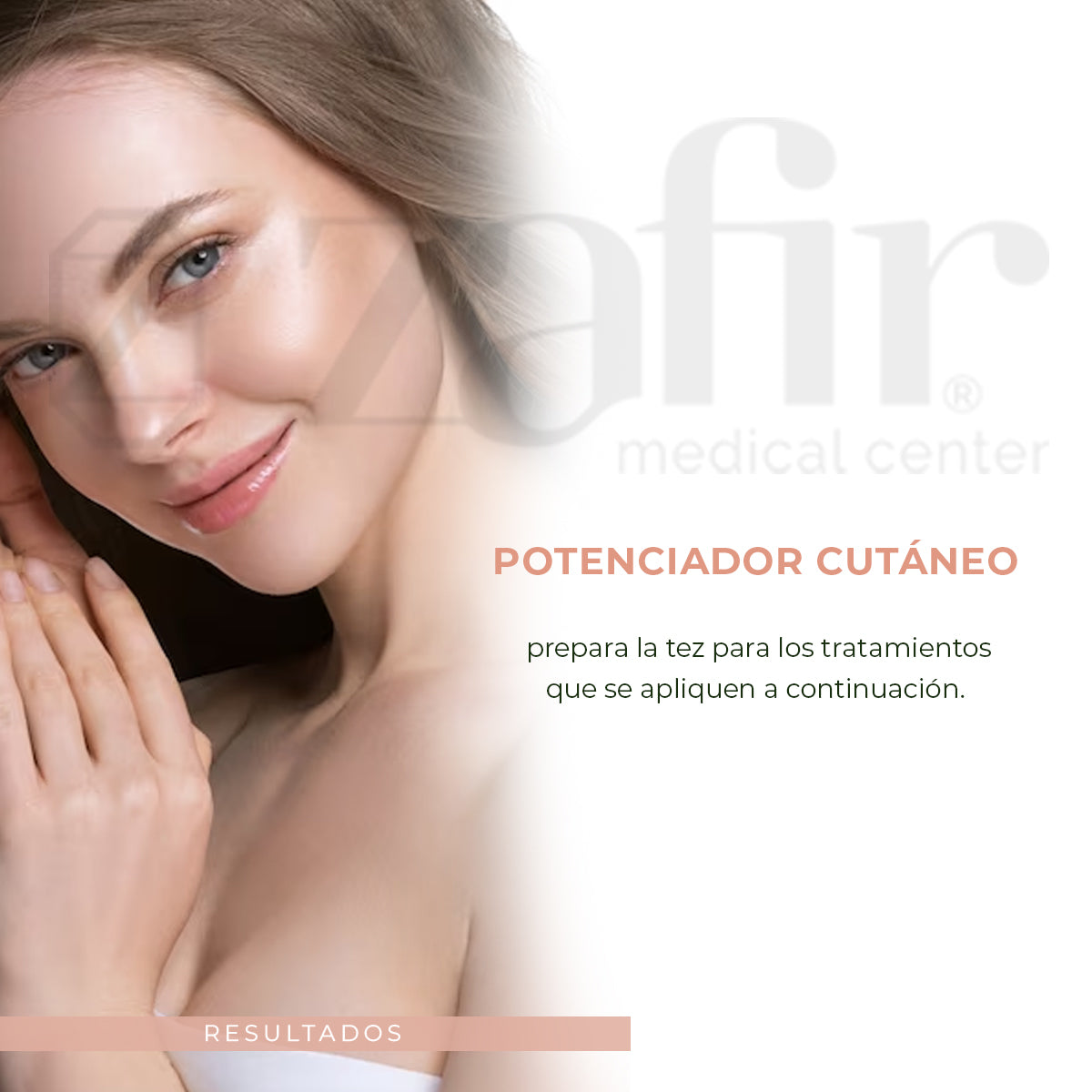 FILORGA Ncef-essence: esencia regeneradora antiedad 150ml