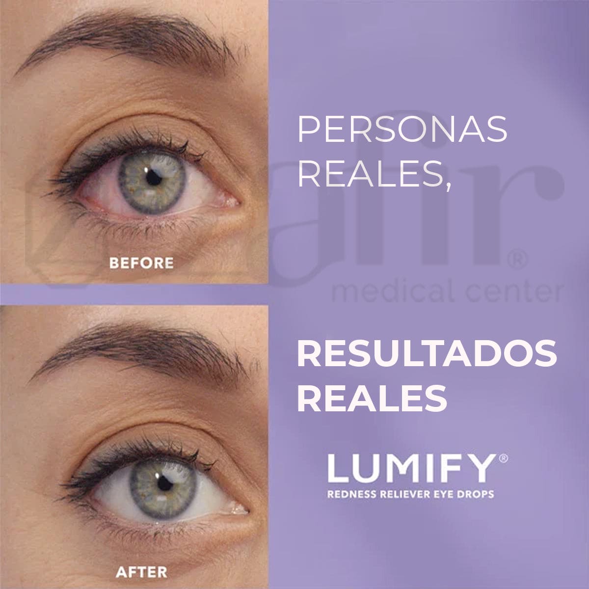 LUMIFY Eye Drops (Gotas Para Ojos) 2.5ML