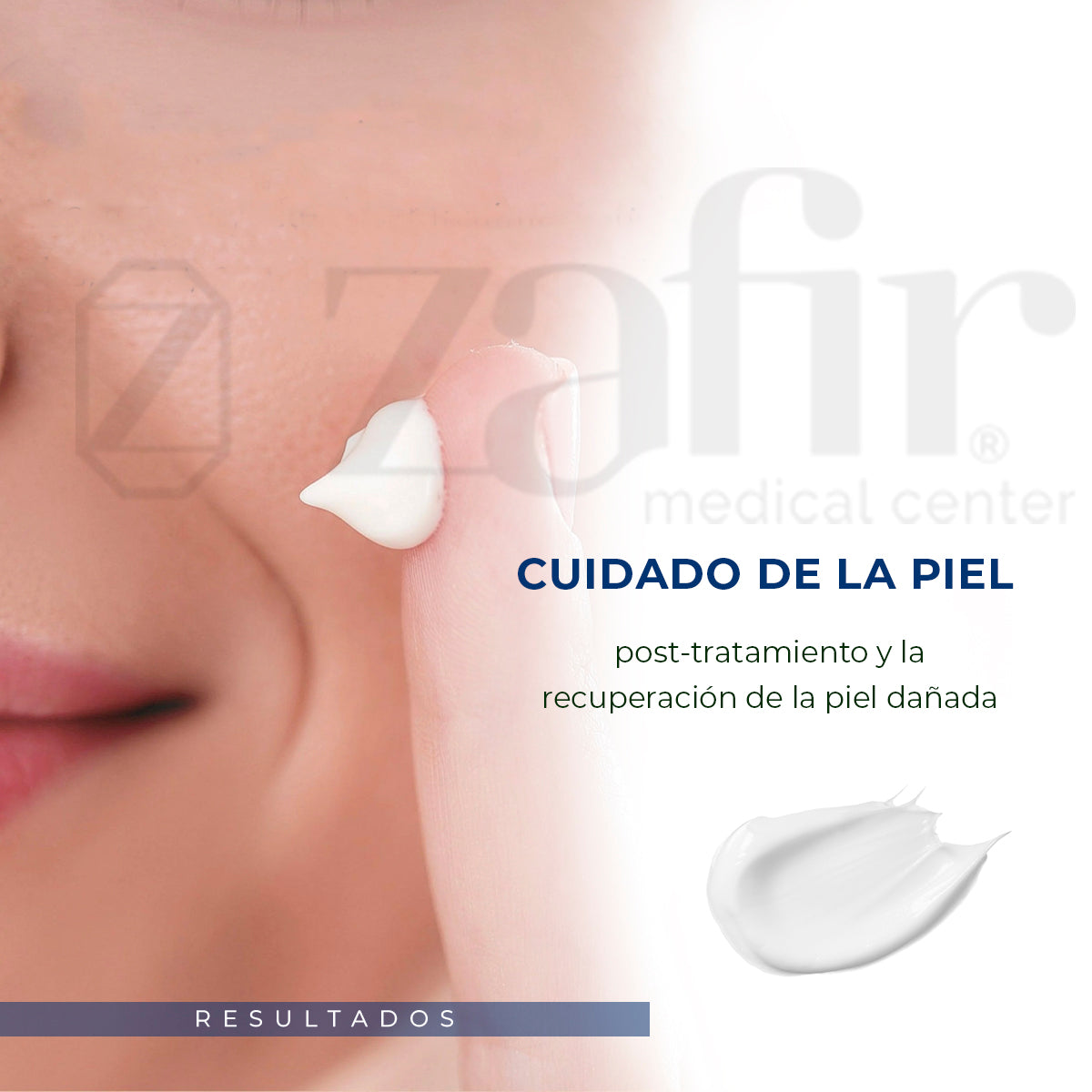 Cica Cream Glutanex Elimina Cicatrices