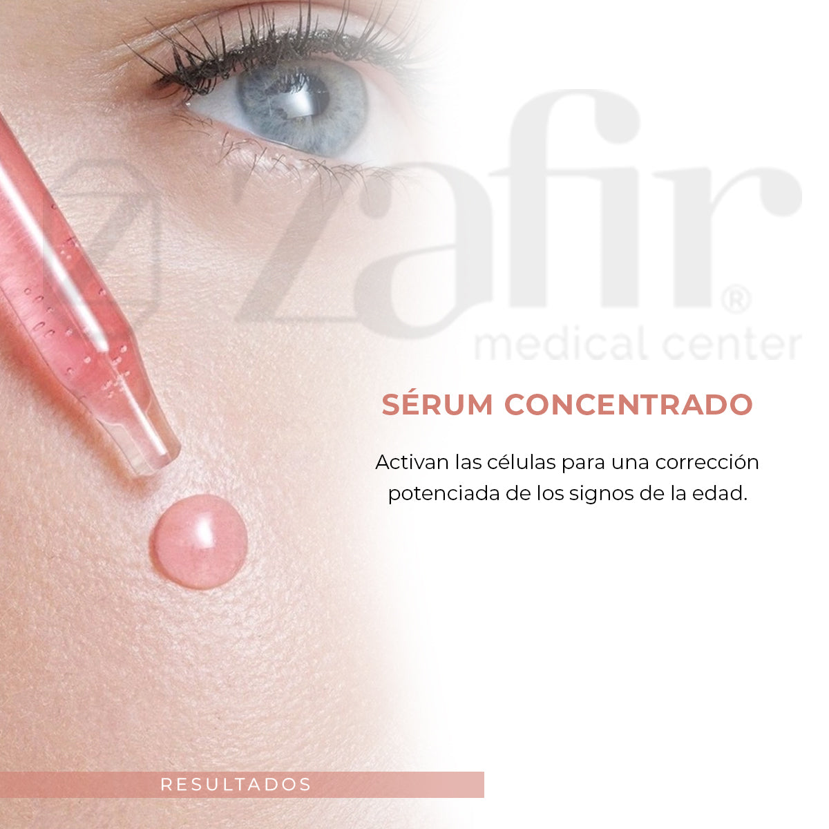 FILORGA Ncef-Shot multicorrector antienvejecimiento (15 ml)
