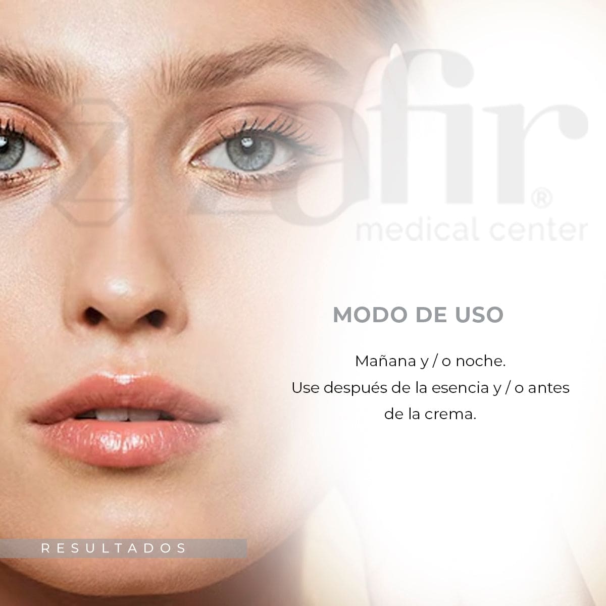 Filorga Ncef Reverse Intensive