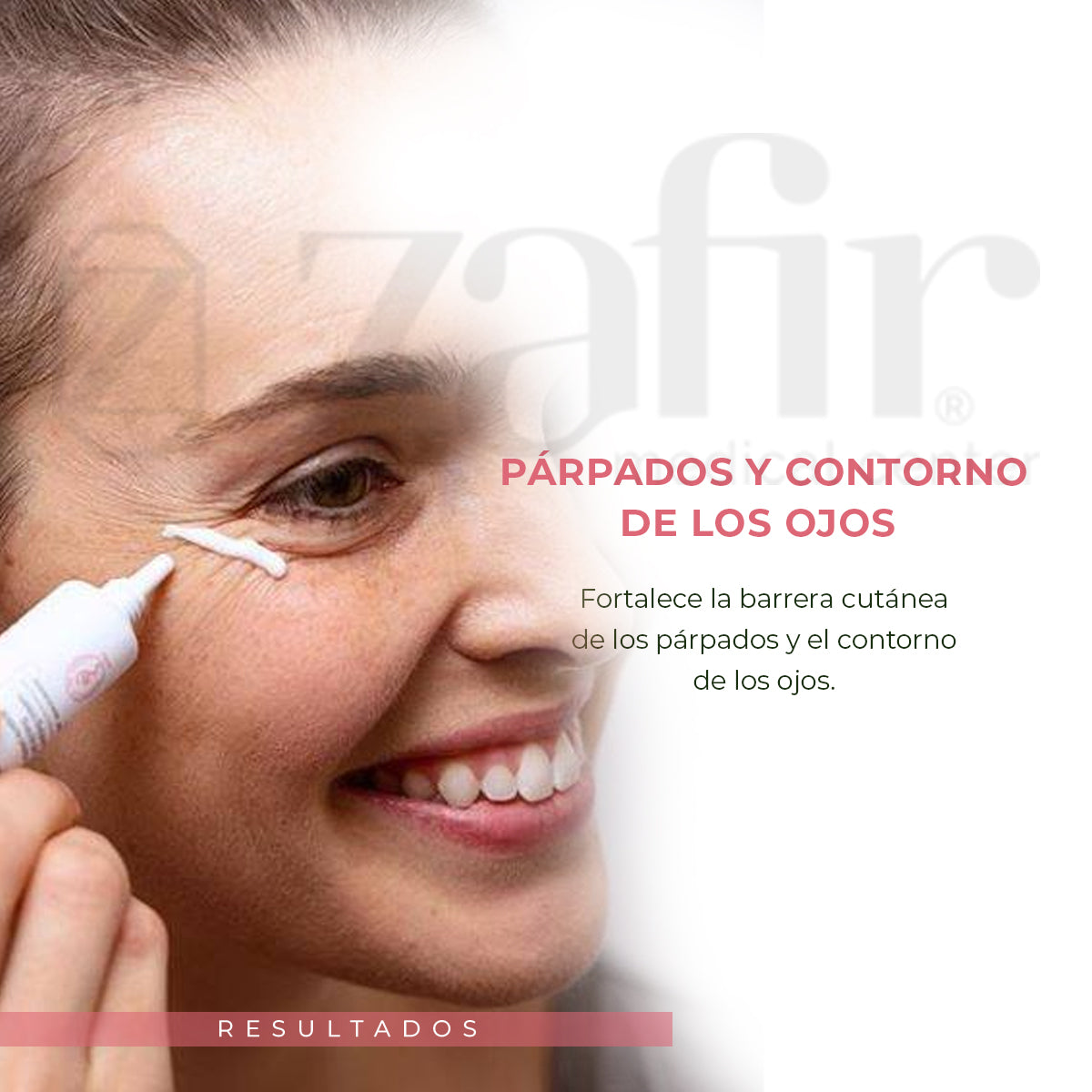 SVR TOPIALYSE CREMA DE CONTORNO DE OJOS