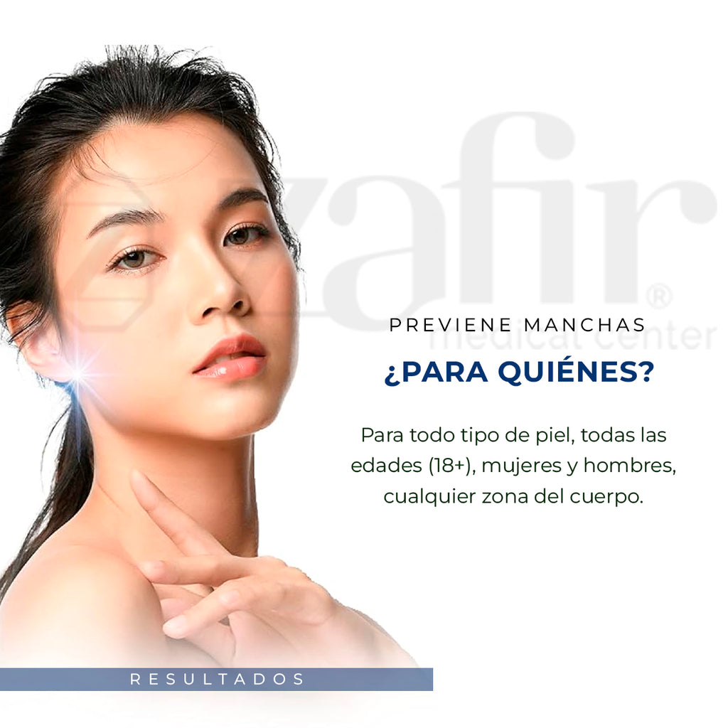 Removedor Melasma Glutanex Spot Cream