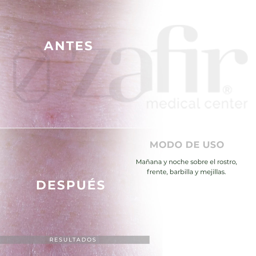 Suero Efecto Lifting  PATYKA - AGE SPECIFIC INTENSIF Reafirmante