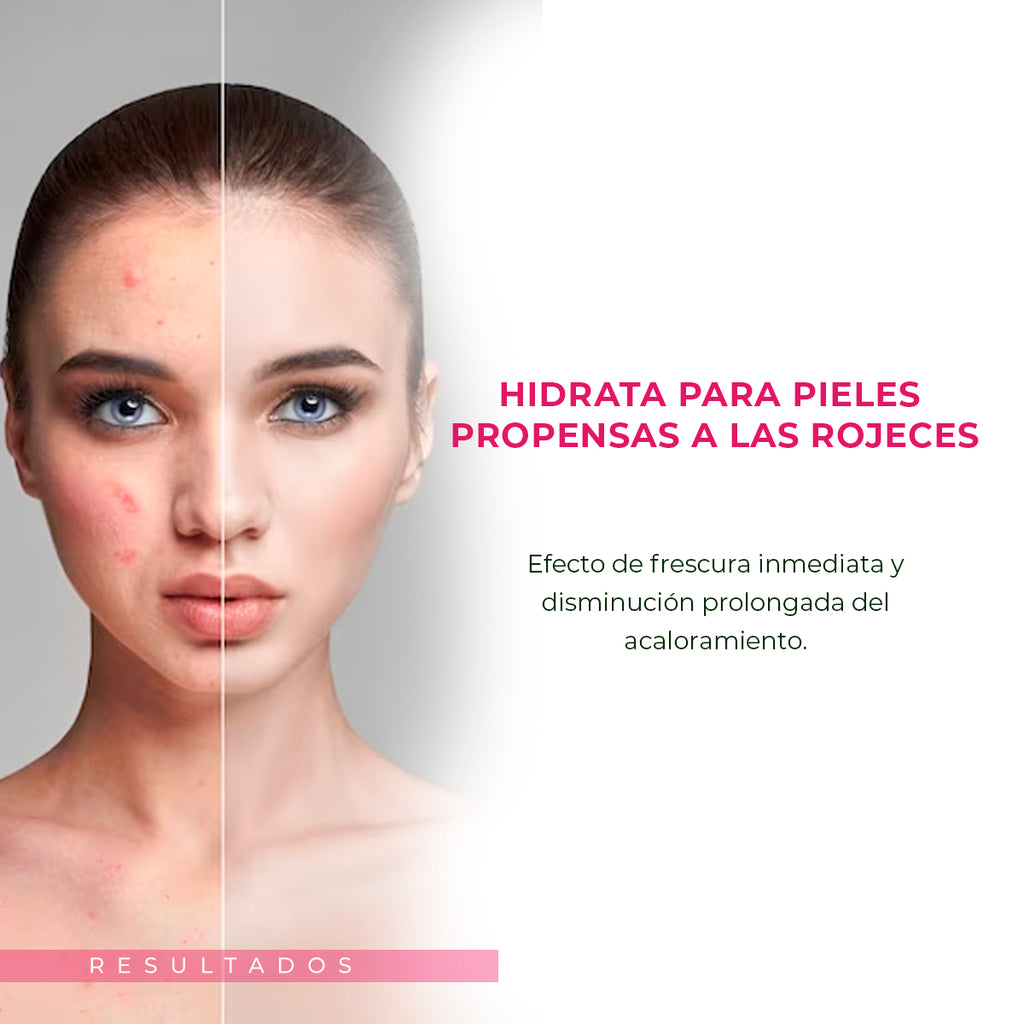 Crema Calmante Svr Creme Riche Sensifine Ar Piel Sensible