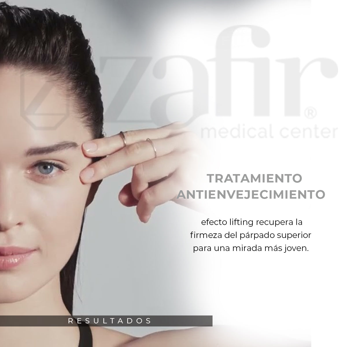 Crema Filorga Time-Filler Eyes 5xp Para Eliminar Ojeras y Arrugas De Los Ojos