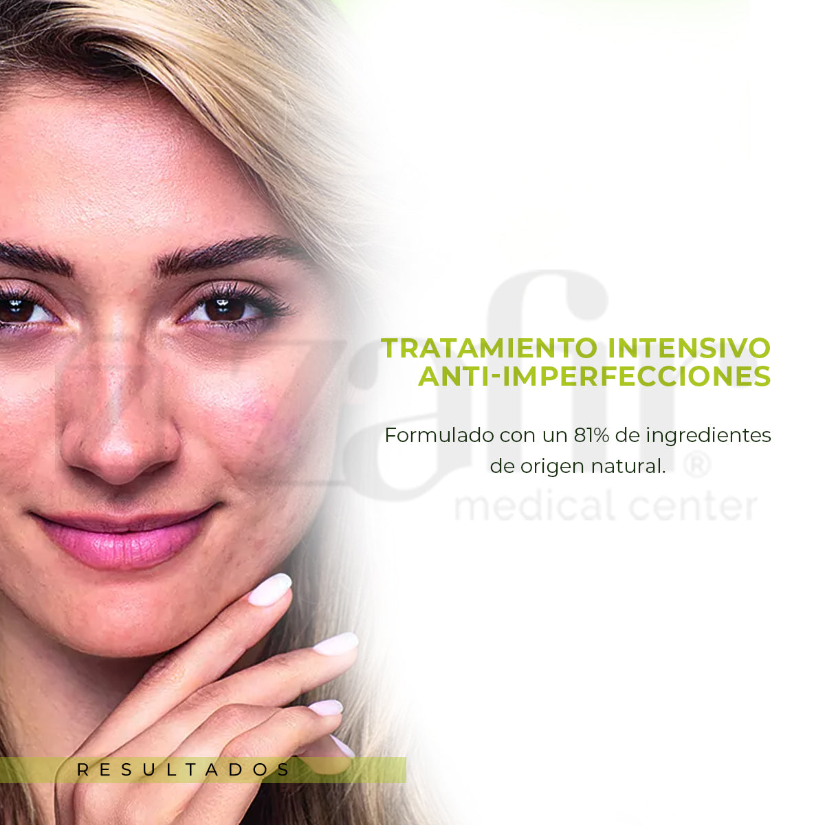 Tratamiento Concentrado Acné Svr Sebiaclear Suero Az 30 Ml