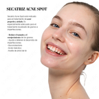 SECATRIZ Acne Spot